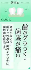 歯がグラつく・歯茎が痛い