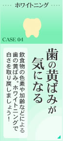 歯の黄ばみが気になる