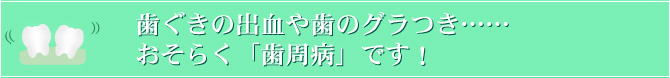 歯ぐきの出血や歯のグラつき……おそらく「歯周病」です！